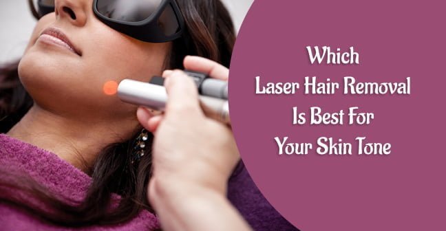 which laser hair removal is best for your skin tone