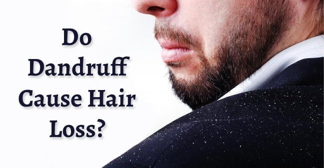 Do Dandruff Cause Hair Loss