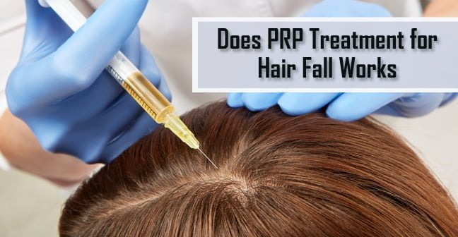 Does-PRP-Treatment-for-Hair-Fall-Works