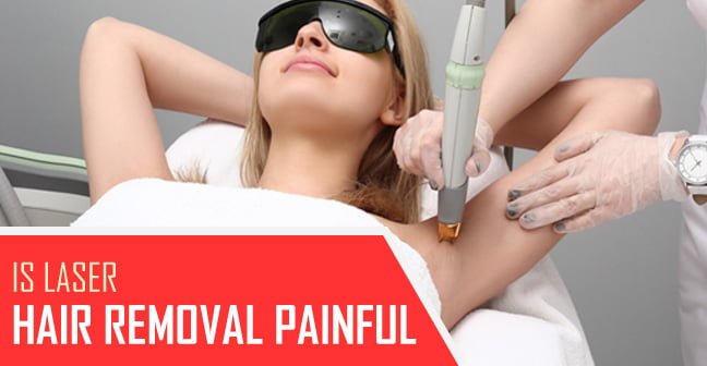 is laser hair removal painful