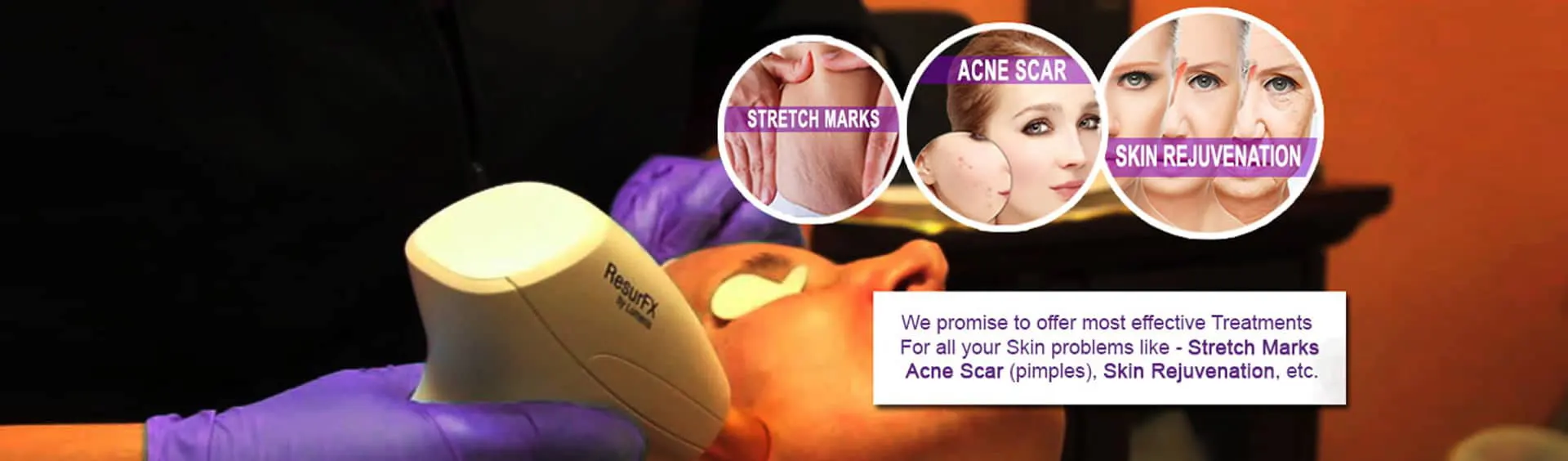 skin-rejuvenation-banner-slide